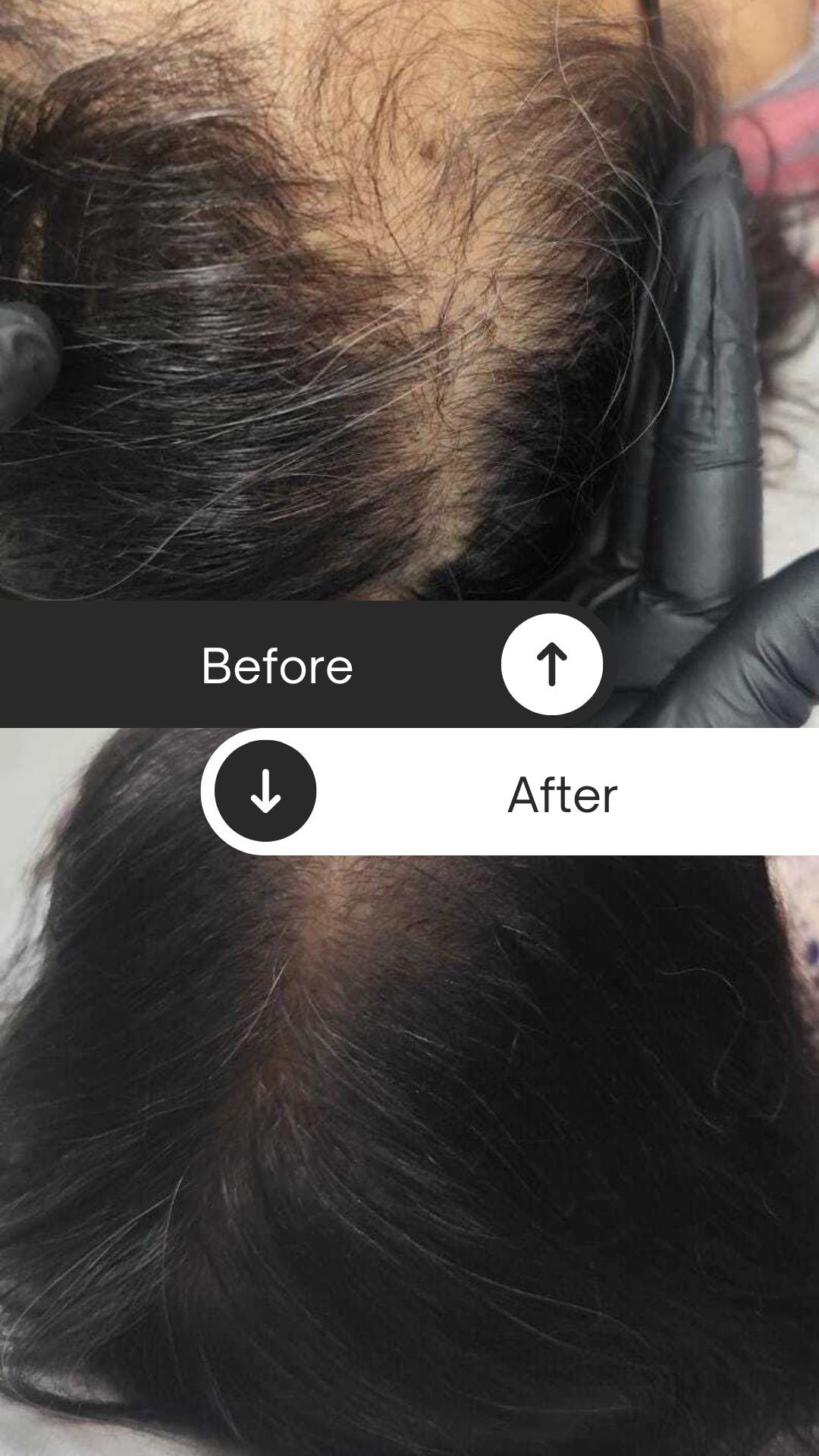 Atlantis Hair Regeneration