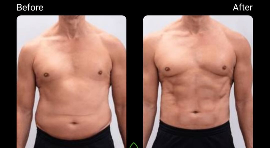 Dr Lipo+