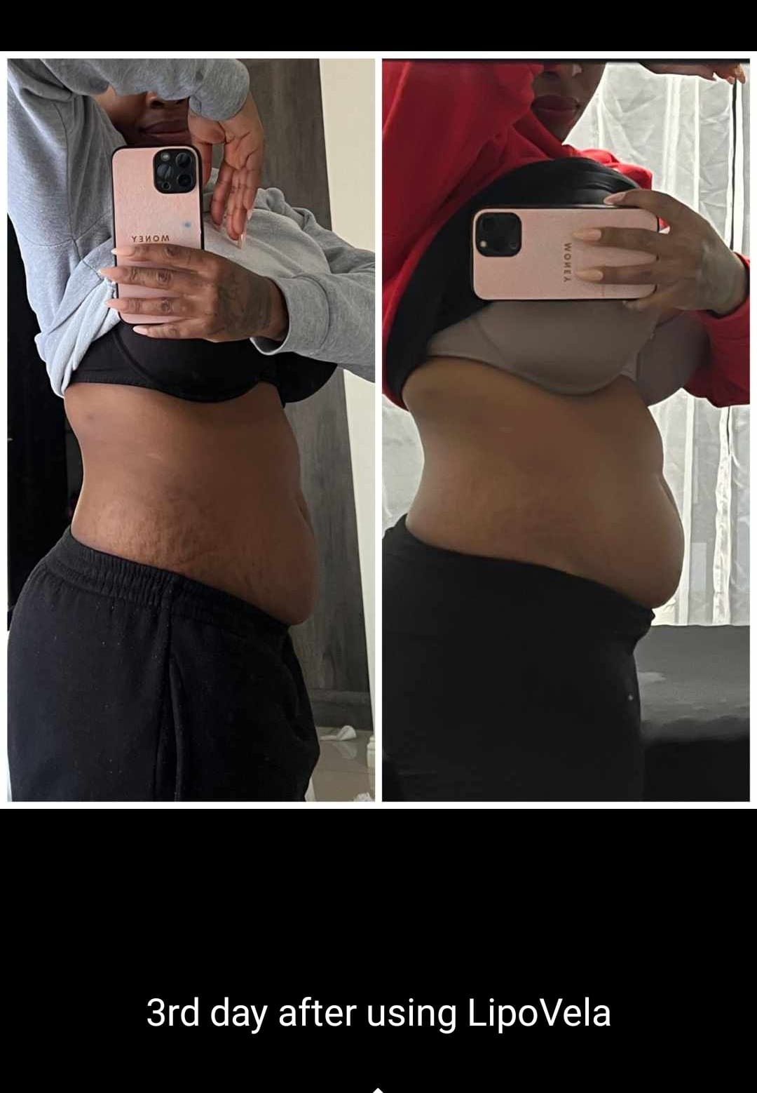 Lipo Vela
