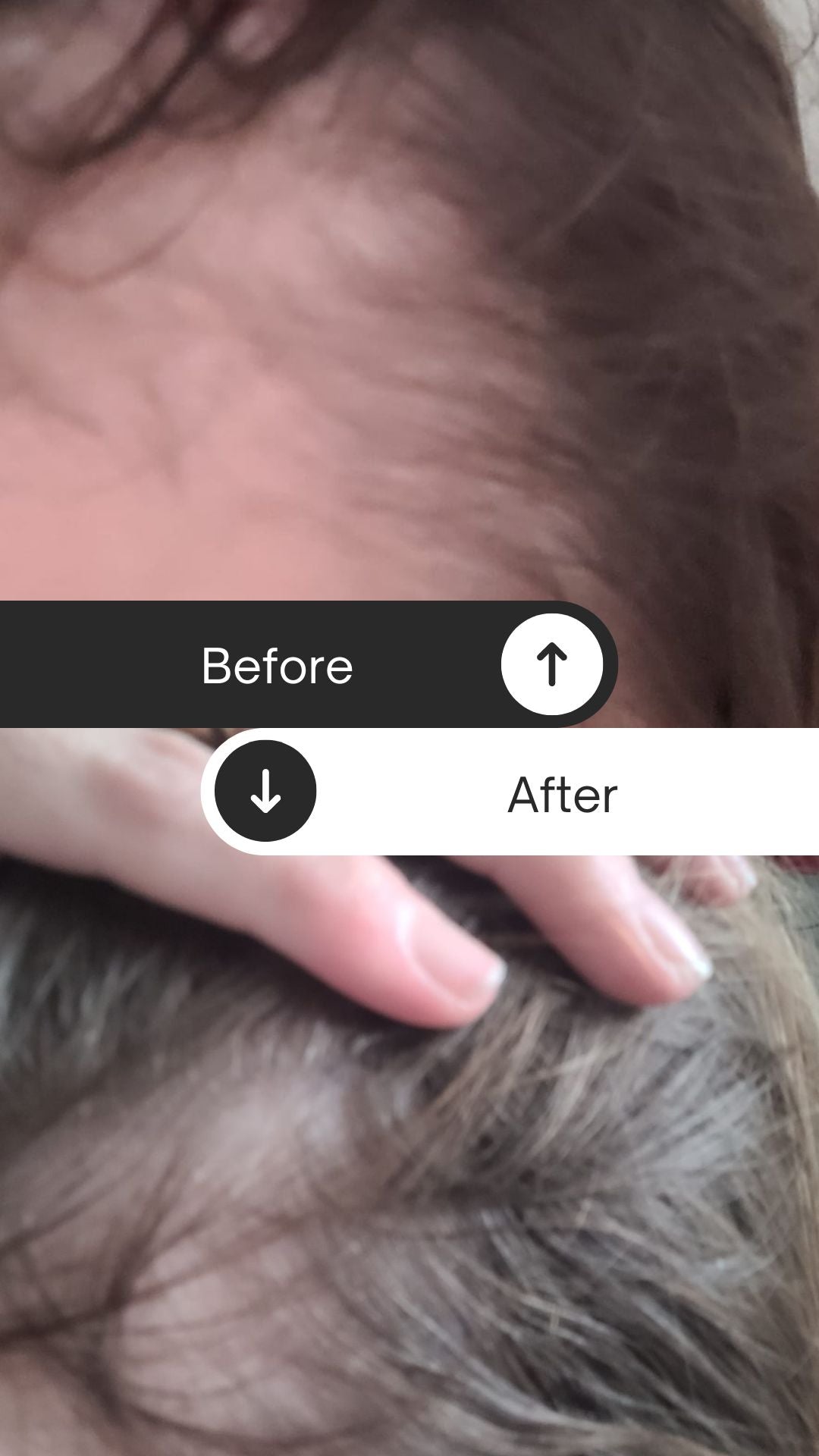 Atlantis Hair Regeneration